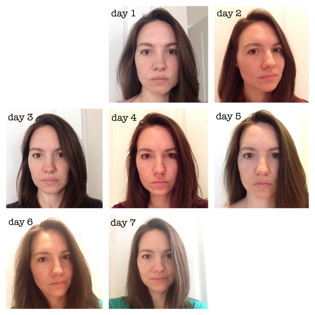 the-process-tretinoin-before-and-after-musely